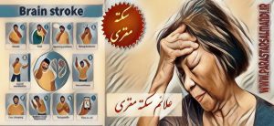 علائم سکته مغزی